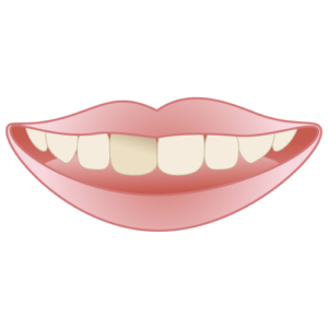 前歯が１本だけ黒いんです という悩みの解決方法 パーク歯科クリニック 仙台市宮城野区新田東